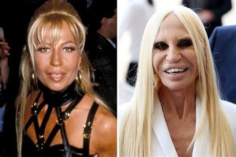 donatella versace politica|donatella versace plastic surgery.